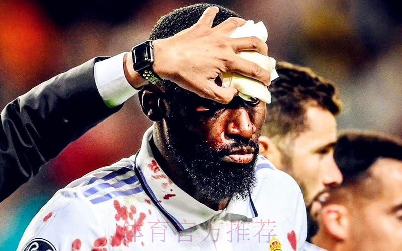 欧冠-吕迪格95分钟绝平+血染赛场!皇马1-1提前出线 欧冠-吕迪格95分钟绝平+血染赛场!皇马1-1提前出线